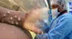 Viruela del mono viene esparciéndose en el Perú. Viruela del mono o Mpox en Perú, según Minsa.