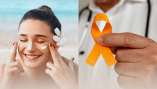 Verano seguro: conoce la CAMPAÑA de prevención que tu piel necesita